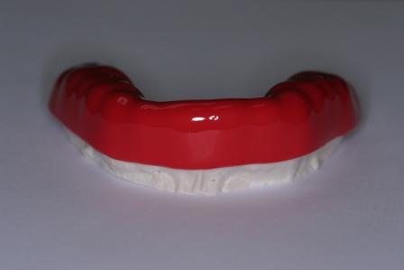 MouthGuard Sample Sample