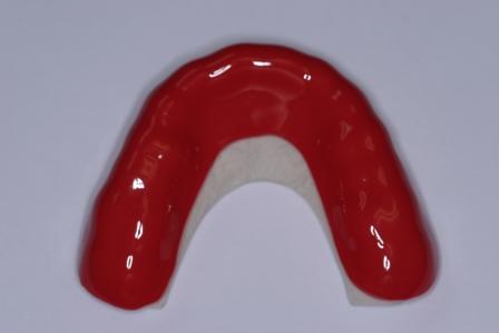 MouthGuard Sample2 Sample2